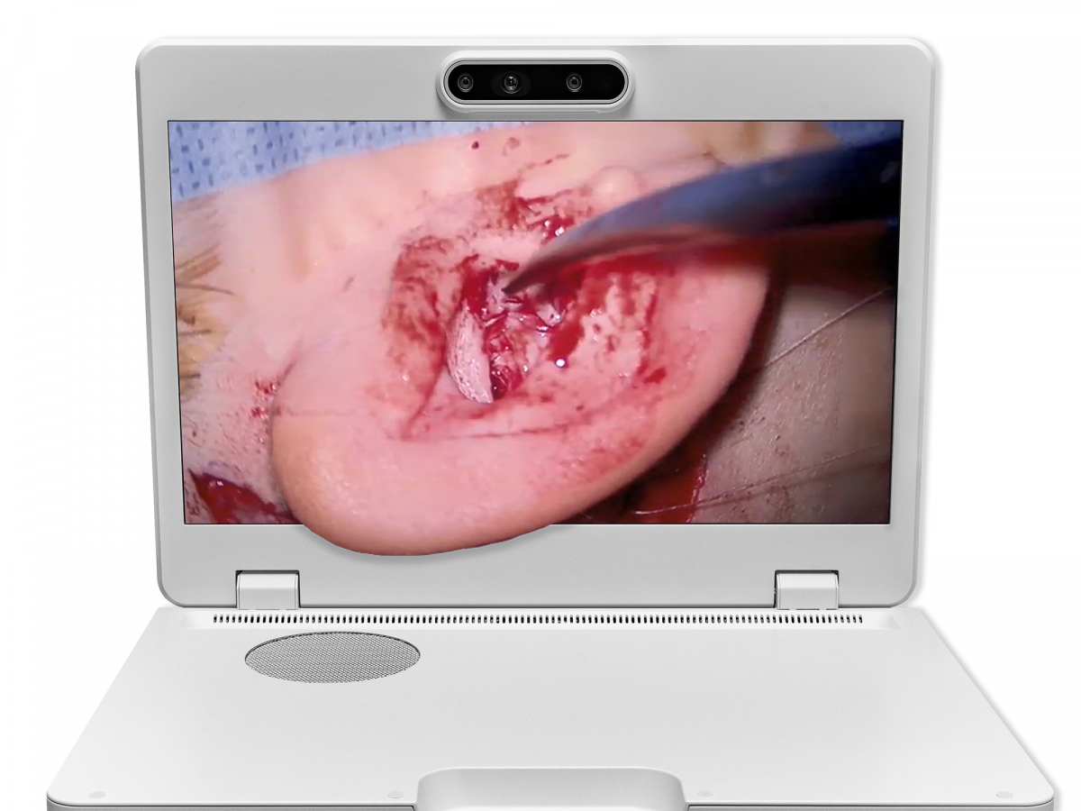 达擎之＂Heads-up 3D显微手术显示系统＂，整合4K裸眼3D显示及眼球追踪系统，具备快速追踪人眼移动位置功能，减轻医师长时间维持固定姿势的负担，让医师能有更宽广清晰的3D立体视野及更舒适的姿势来执行手术。